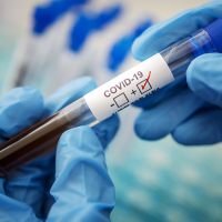 В  Саратовской области проведено более 2 миллионов 136 тысяч исследований на коронавирус